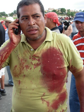  Honduran soldiers opened fire Sunday against unarmed protestors. Photo: Luis Miranda
