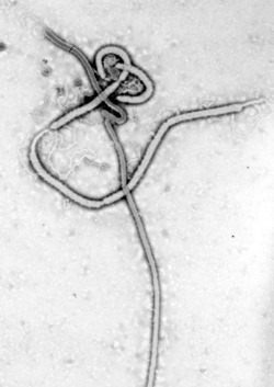 Ebola_virus_em
